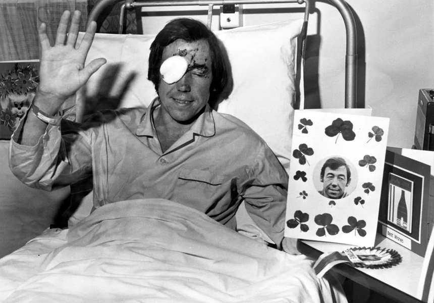 Gordon Banks, England’s star goalkeeper, damaged his eyes in a car crash. Fragments of glass had perforated his right eye and damaged the retina, requiring 100 micro stitches to the eye and a further 200 to his face.